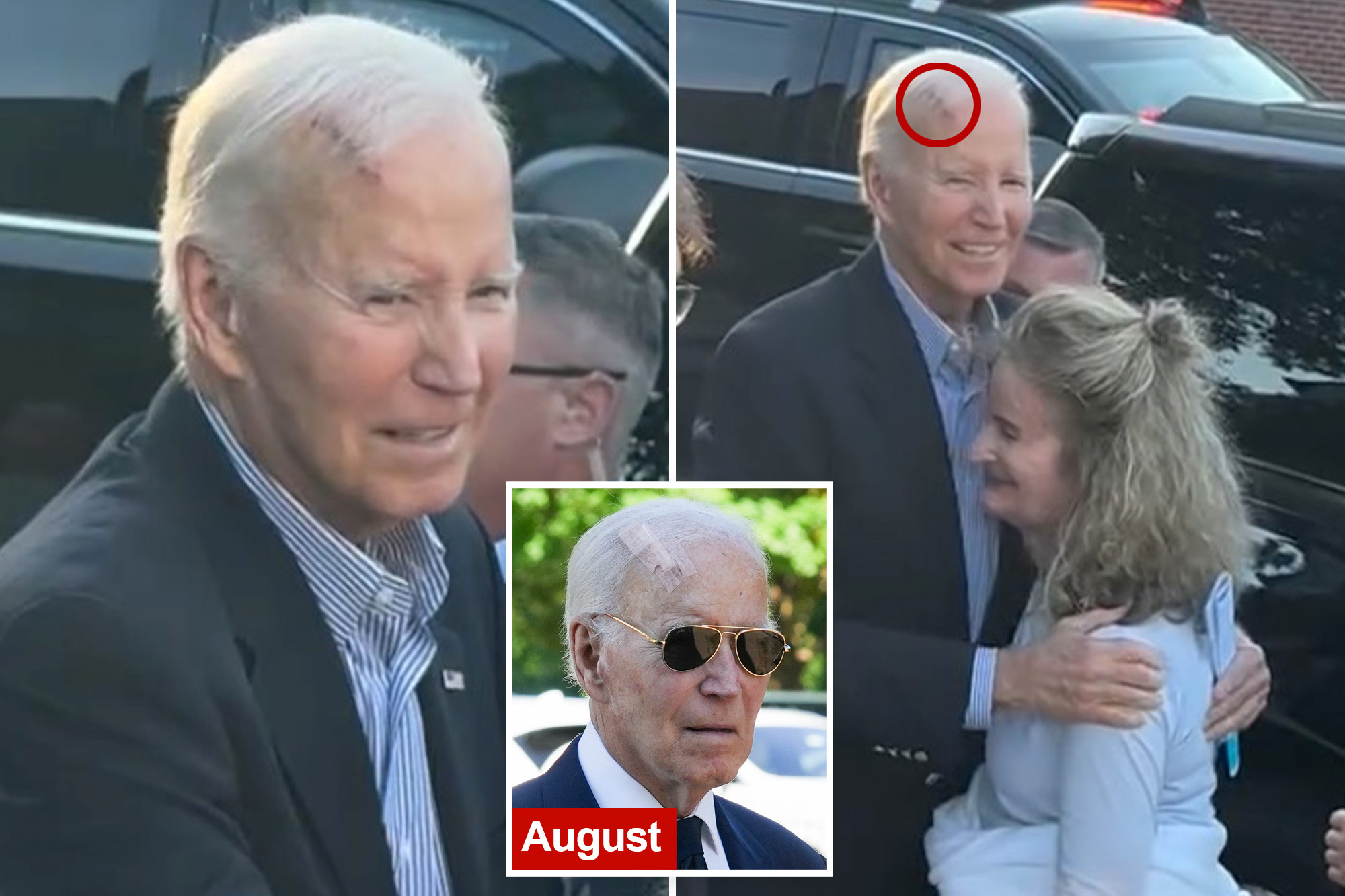 Biden’s Health Crisis Deepens: Massive Head Wound and Ongoing Cancer Treatments Spark Concern